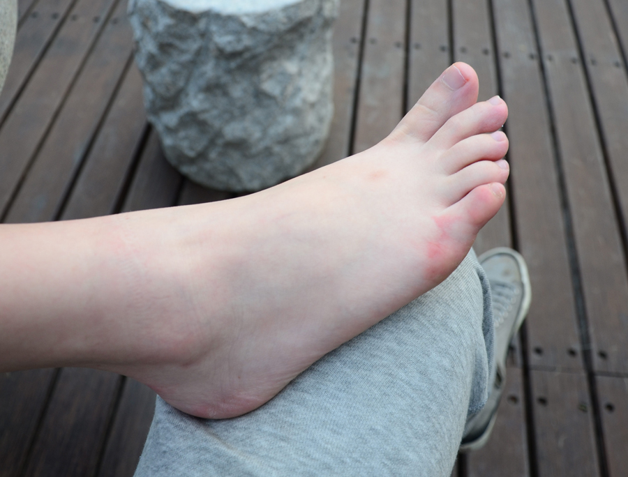 《公园石台上鲜嫩妹子》作品图