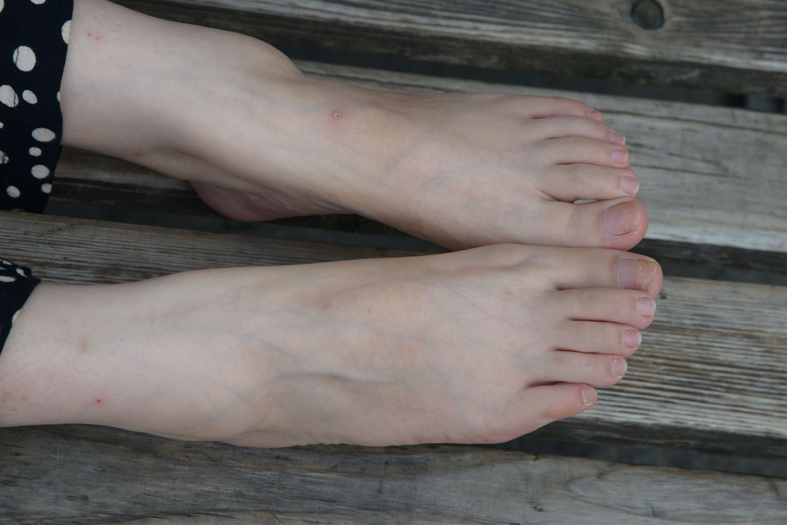 《不露脸的斑点裙の裸足脚丫 》作品图