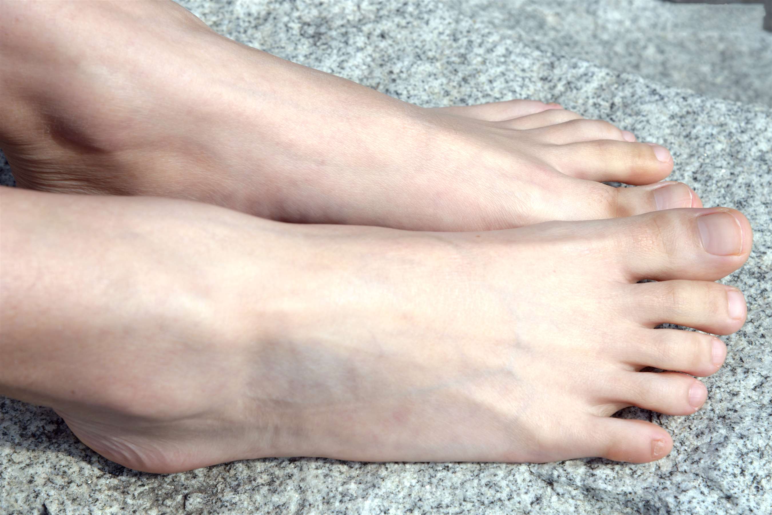 《公园石头上的裸足》作品图