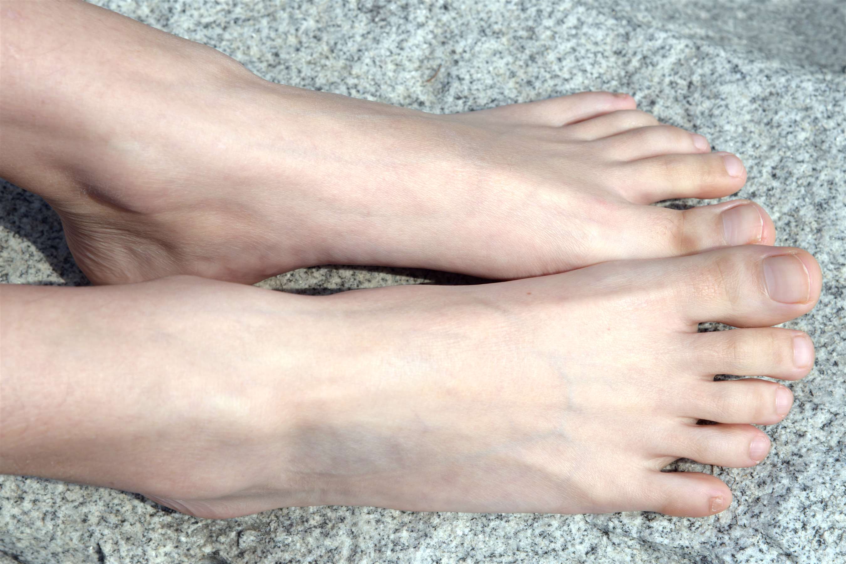 《公园石头上的裸足》作品图