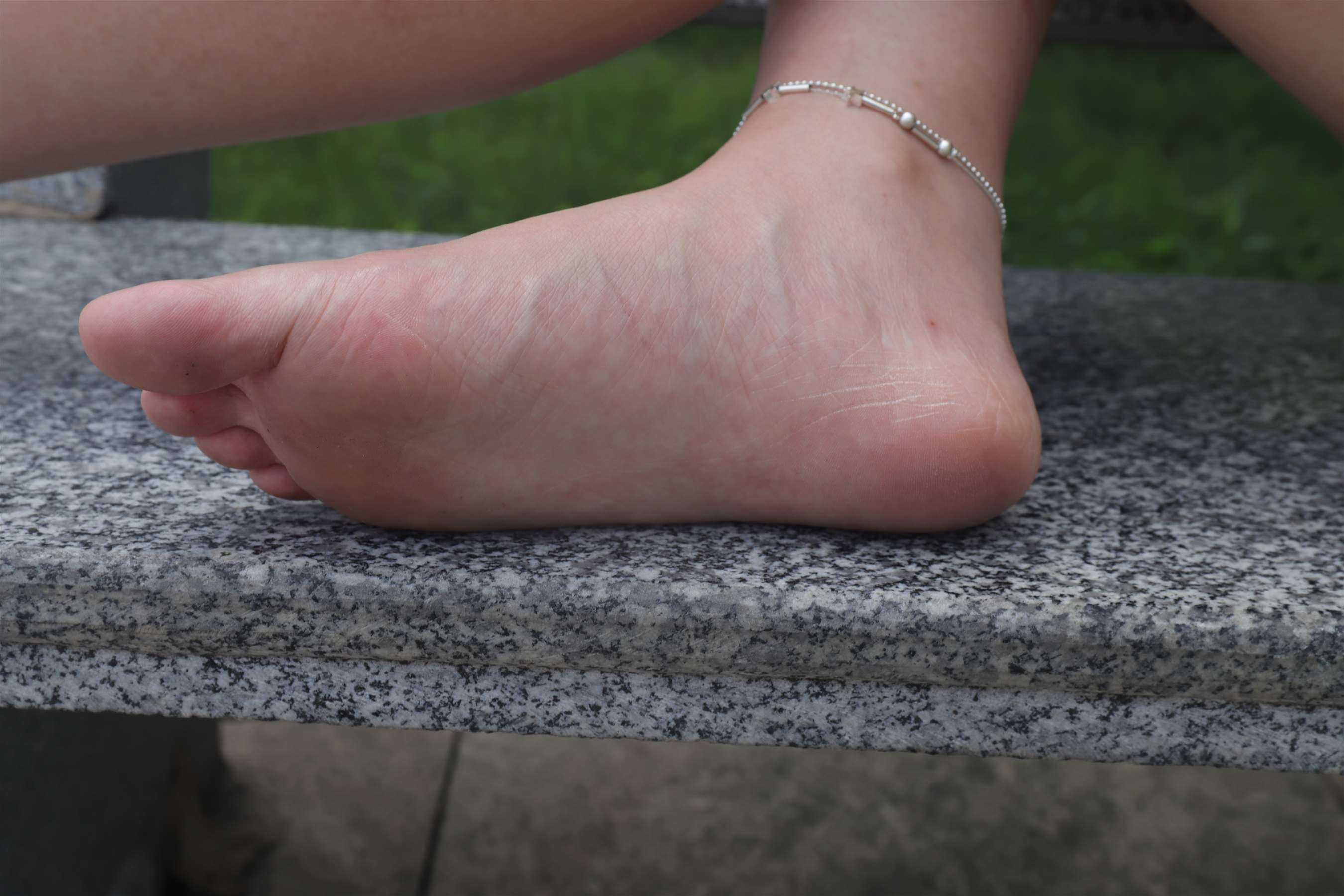 《慧婷公园展示脚丫》作品图