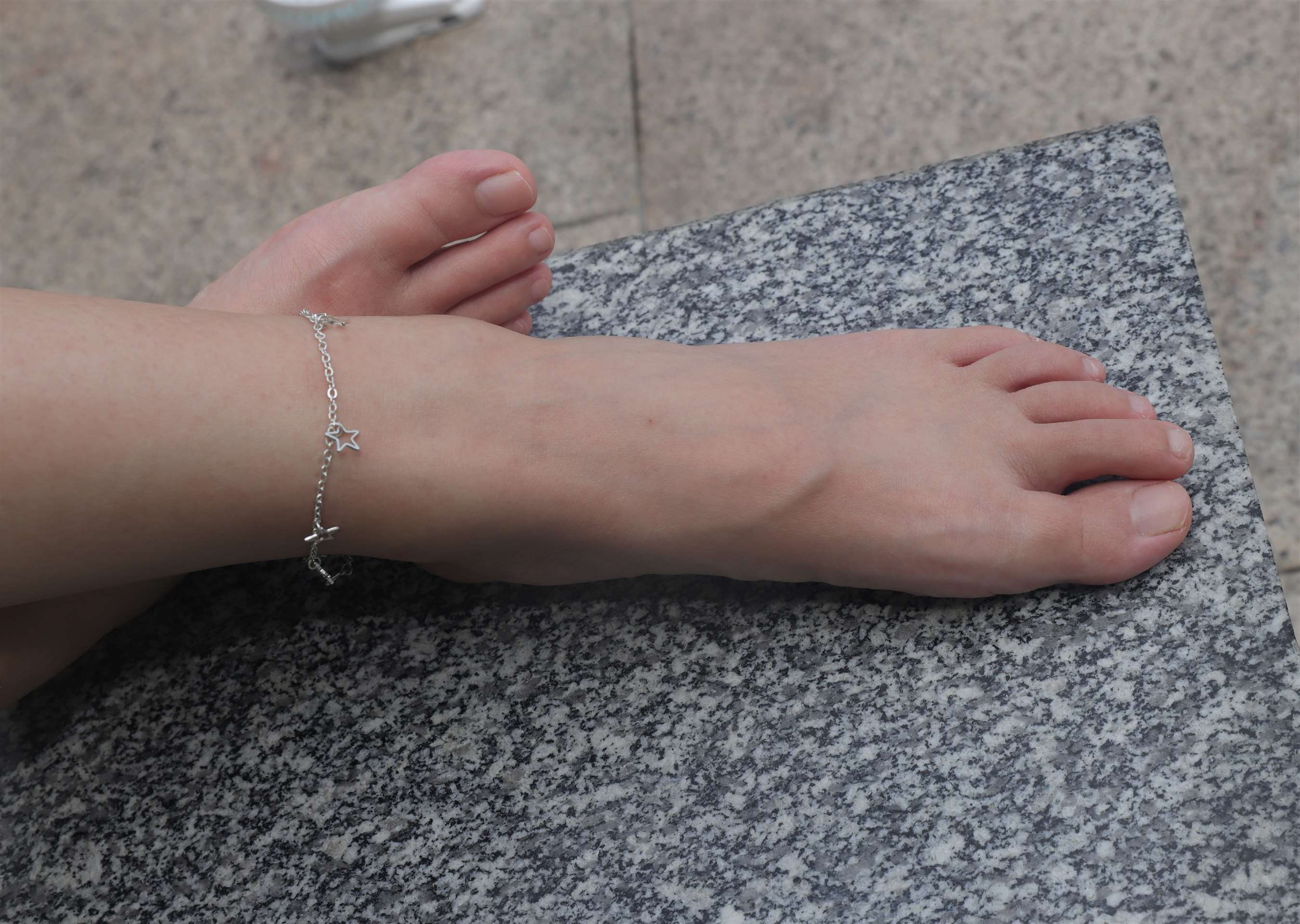 《慧婷公园展示脚丫》作品图