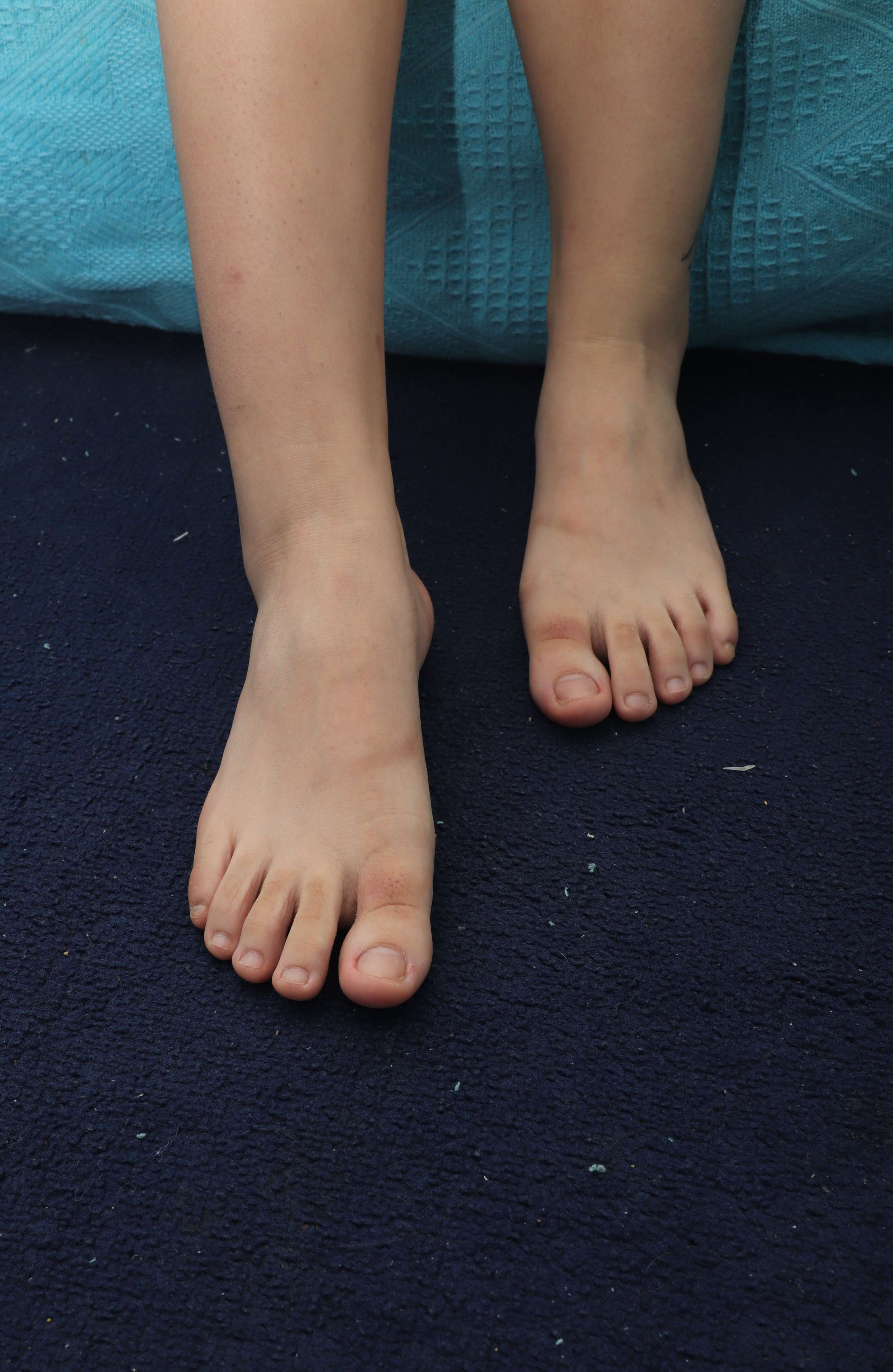 《静儿睡着后脚丫被偷拍》作品图