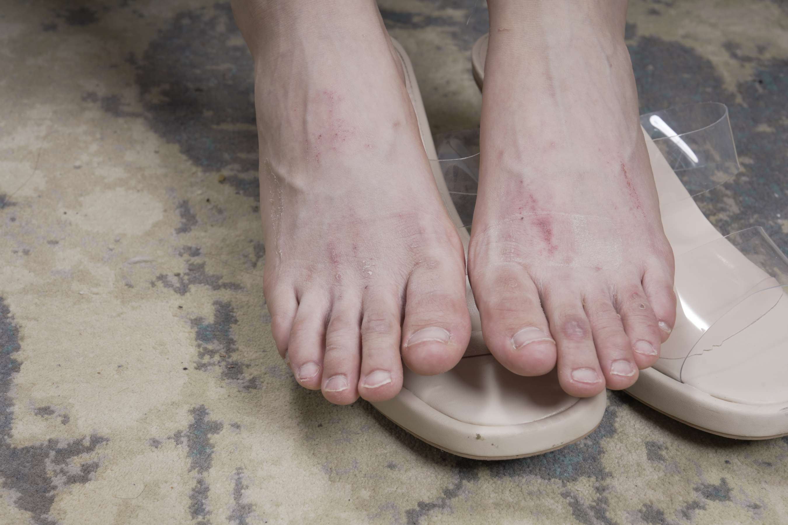 《令仪展示有伤痕的性感脚丫》作品图