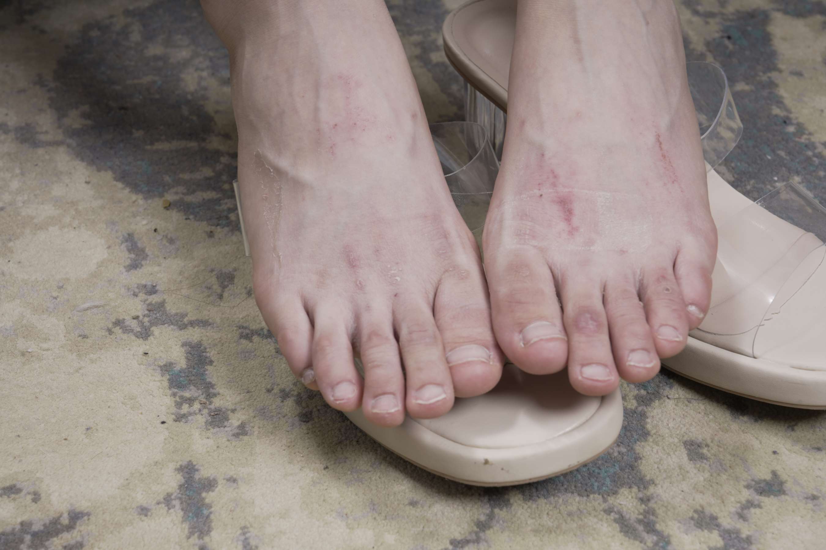 《令仪展示有伤痕的性感脚丫》作品图