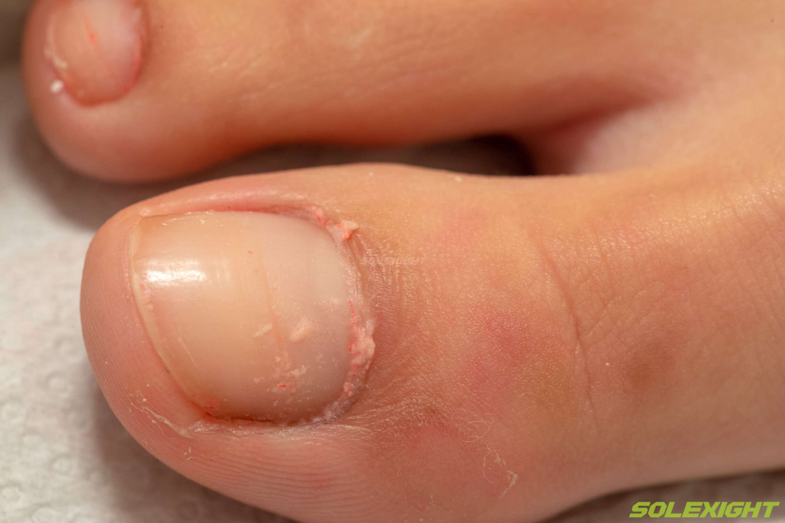 《[寄卖]Chi-正妹脏棉袜凉拖裸足超近特写滴精油》作品图