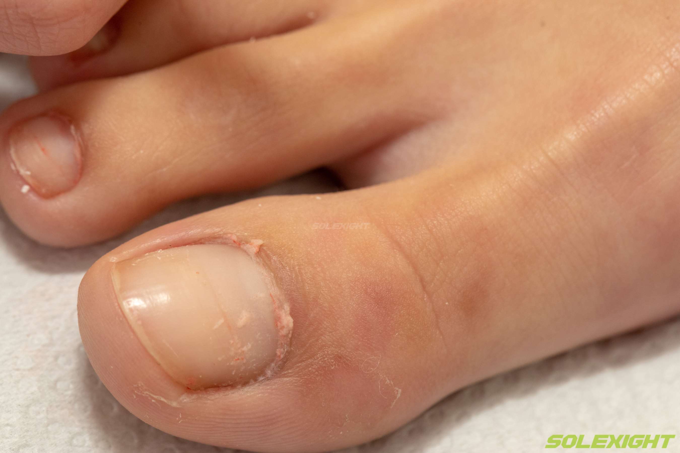 《[寄卖]Chi-正妹脏棉袜凉拖裸足超近特写滴精油》作品图