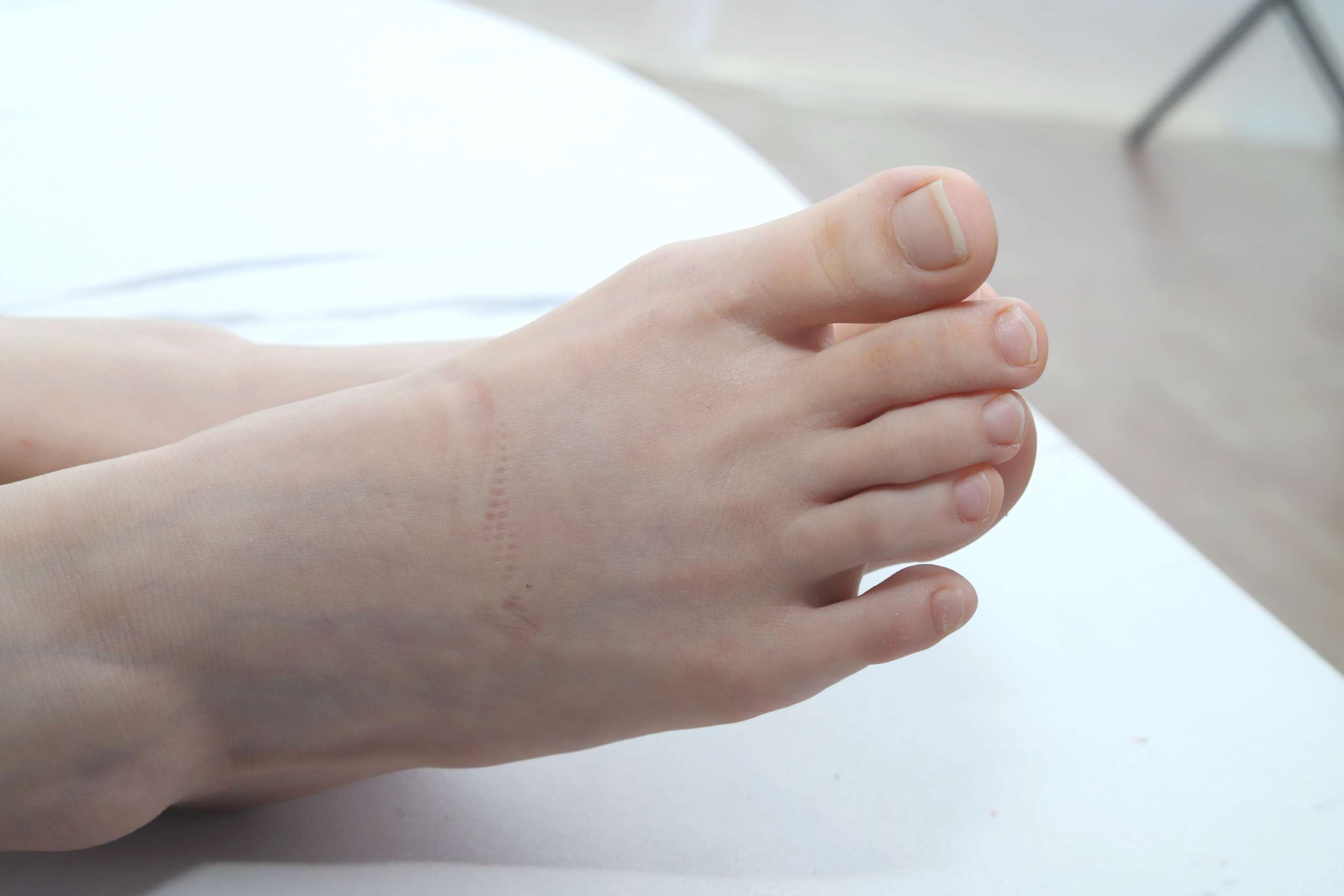 《颖怡的35码小脚丫一手就能完全握住了》作品图