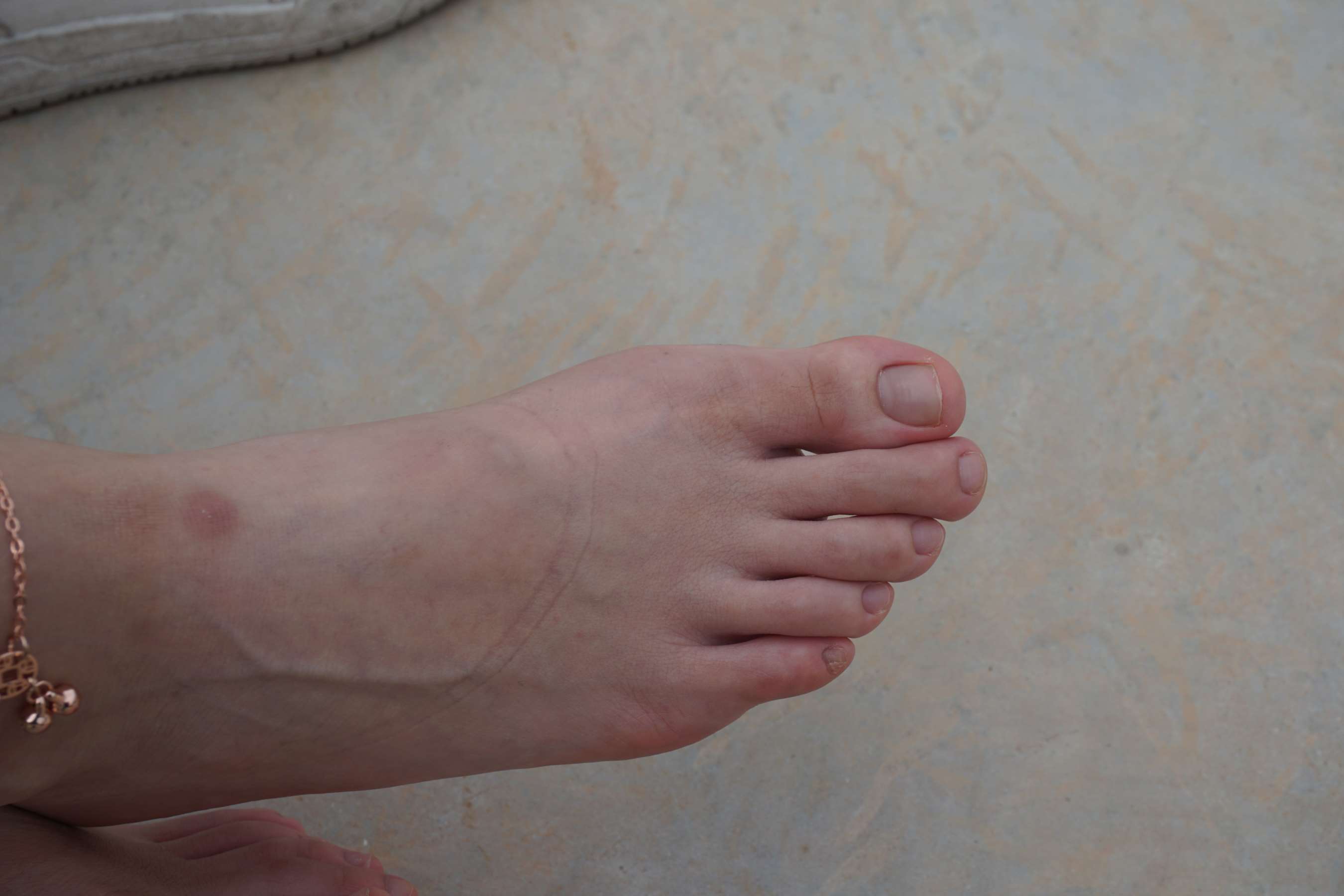 《与小金到体育公园拍脚》作品图