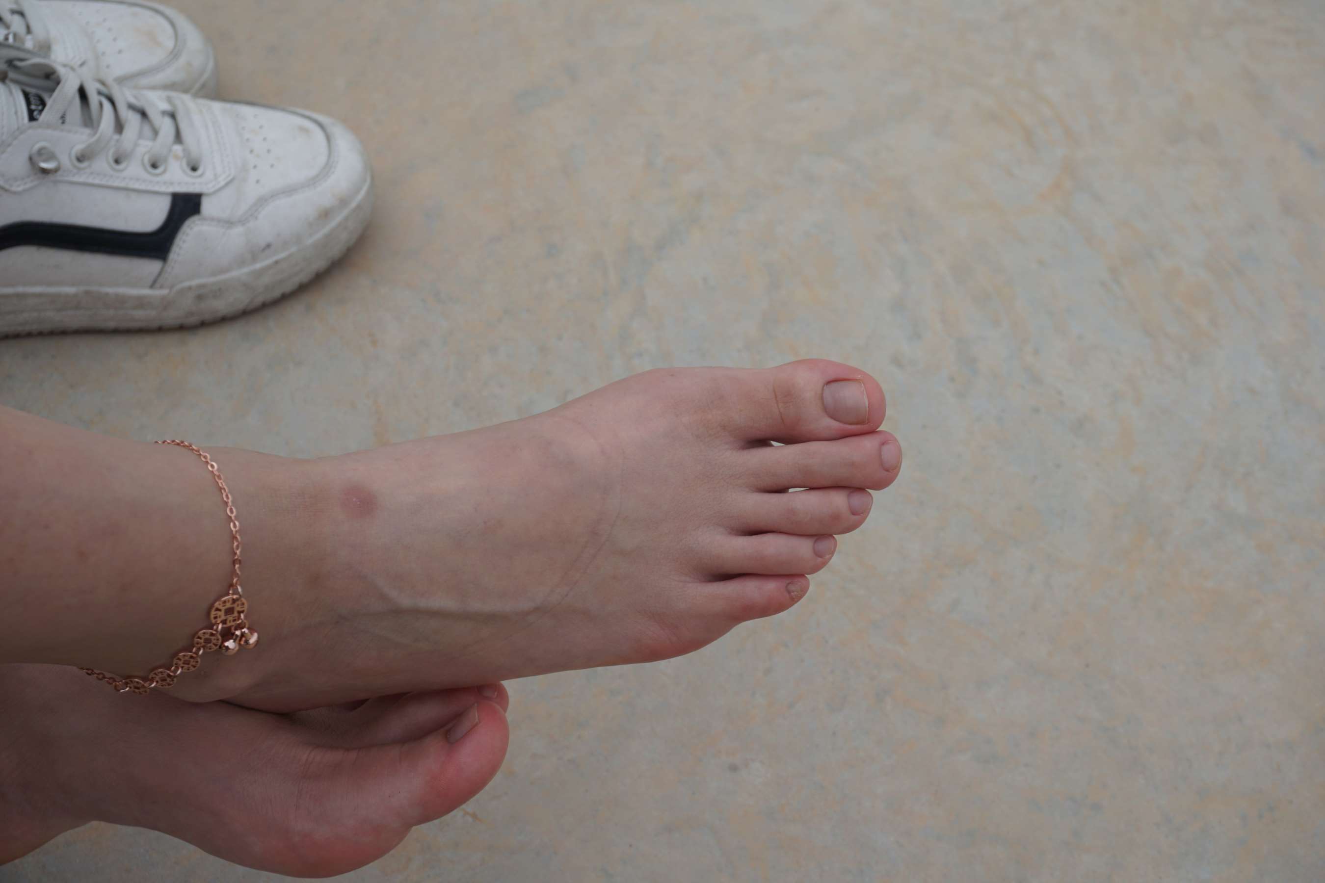 《与小金到体育公园拍脚》作品图