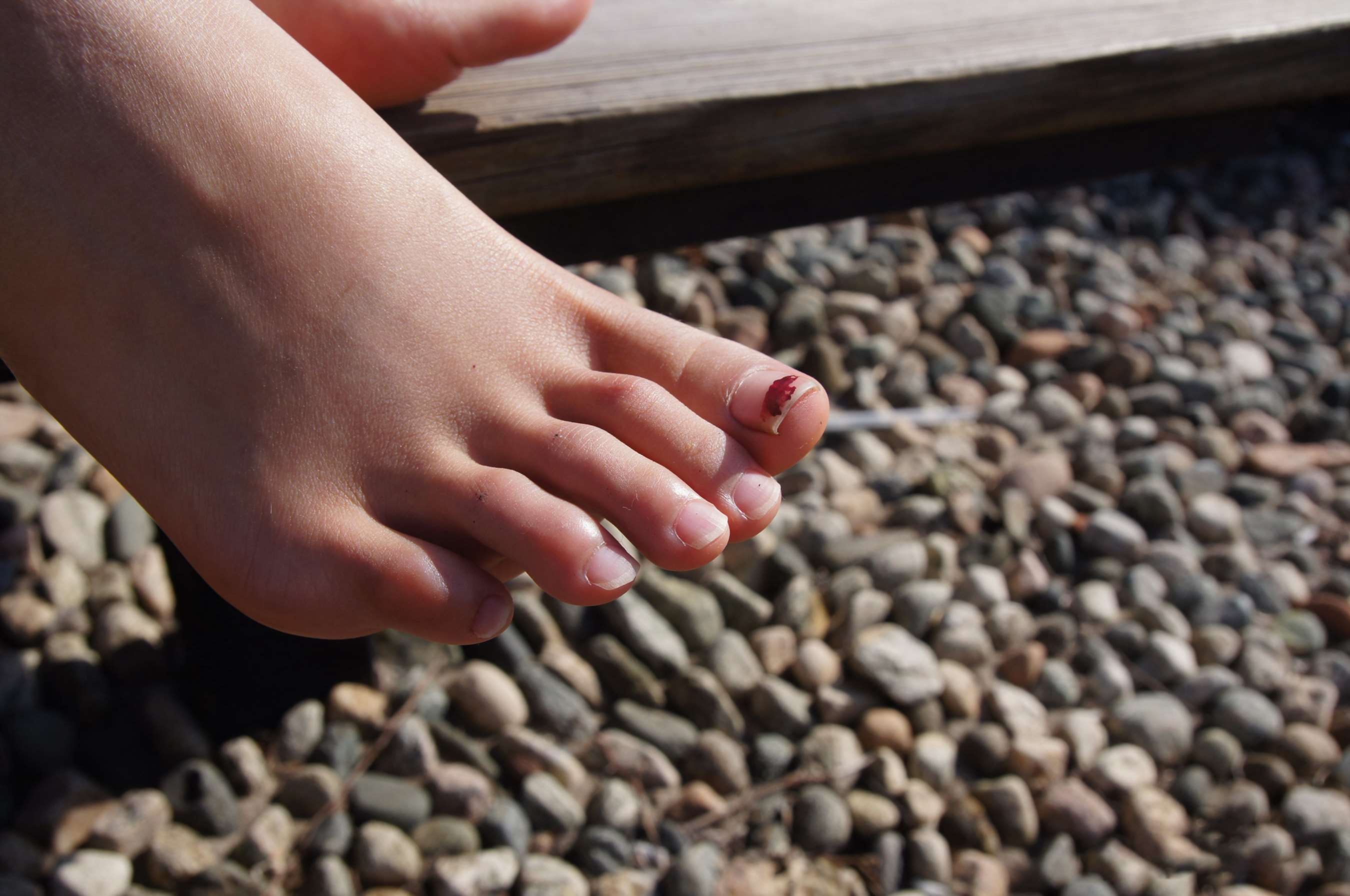 《阿紫超级滑嫩的脚丫》作品图