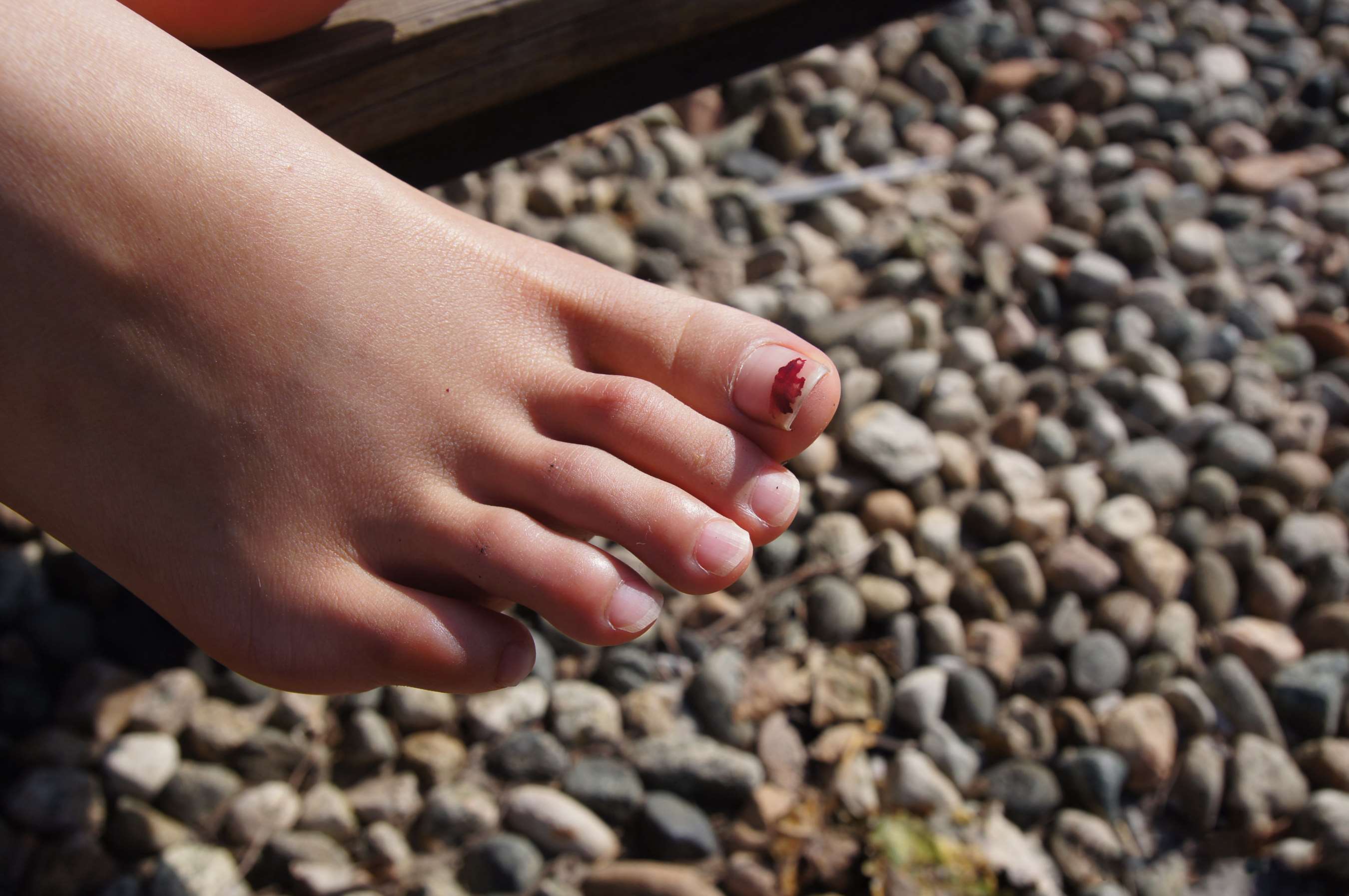 《阿紫超级滑嫩的脚丫》作品图