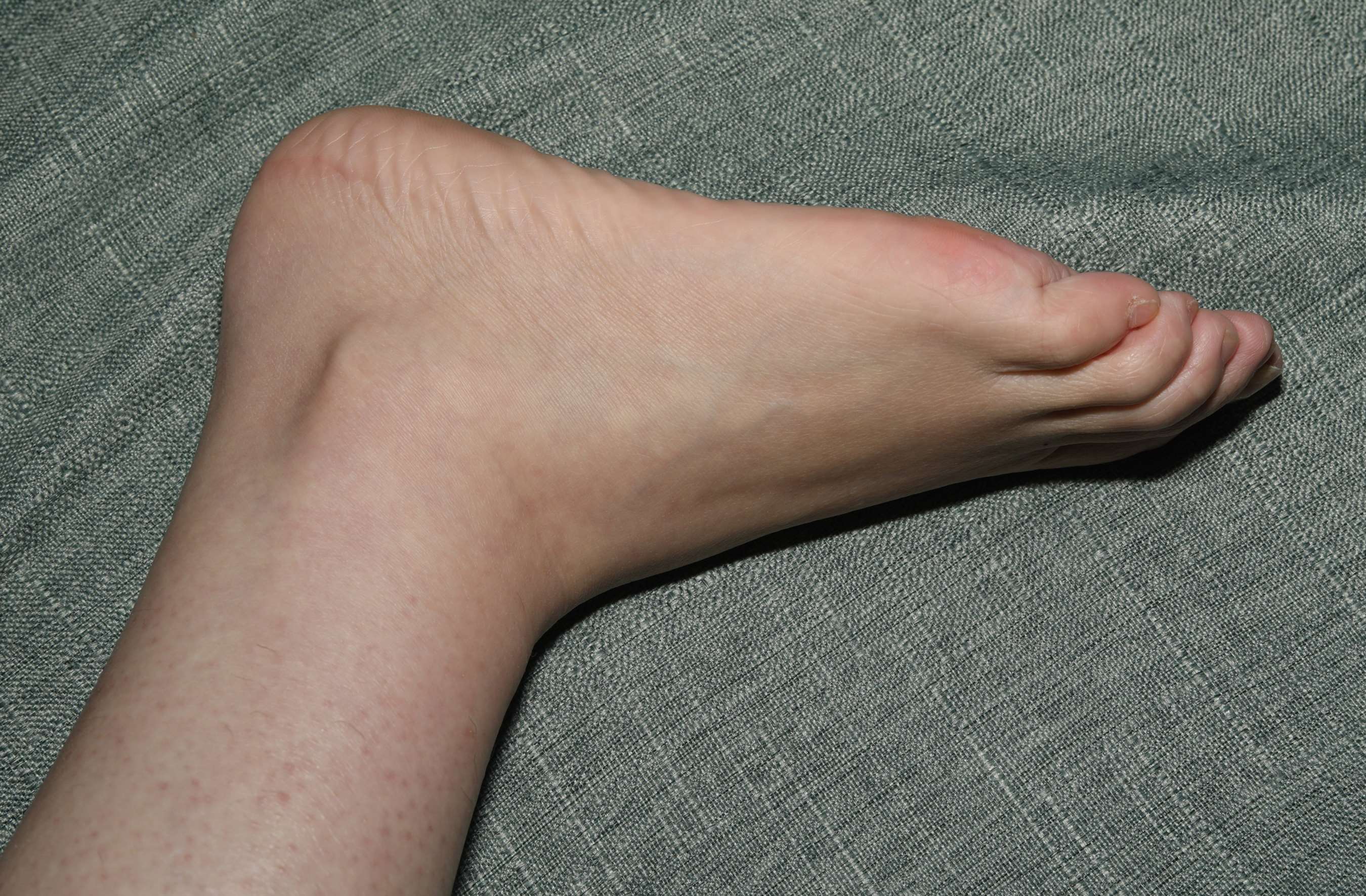 《舞蹈系小欧室内展示38码大美脚》作品图