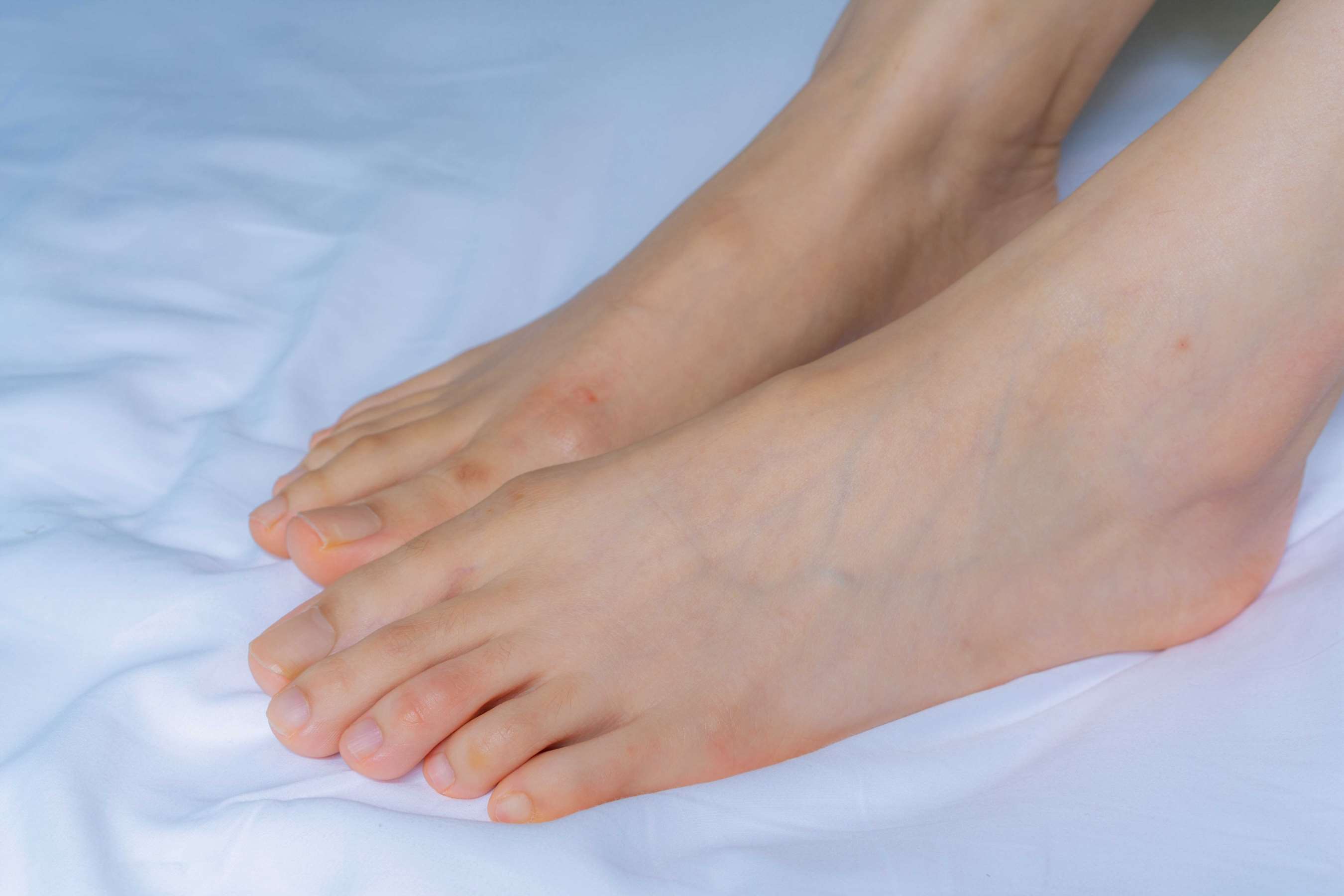 《静怡 足底细致的纹路》作品图