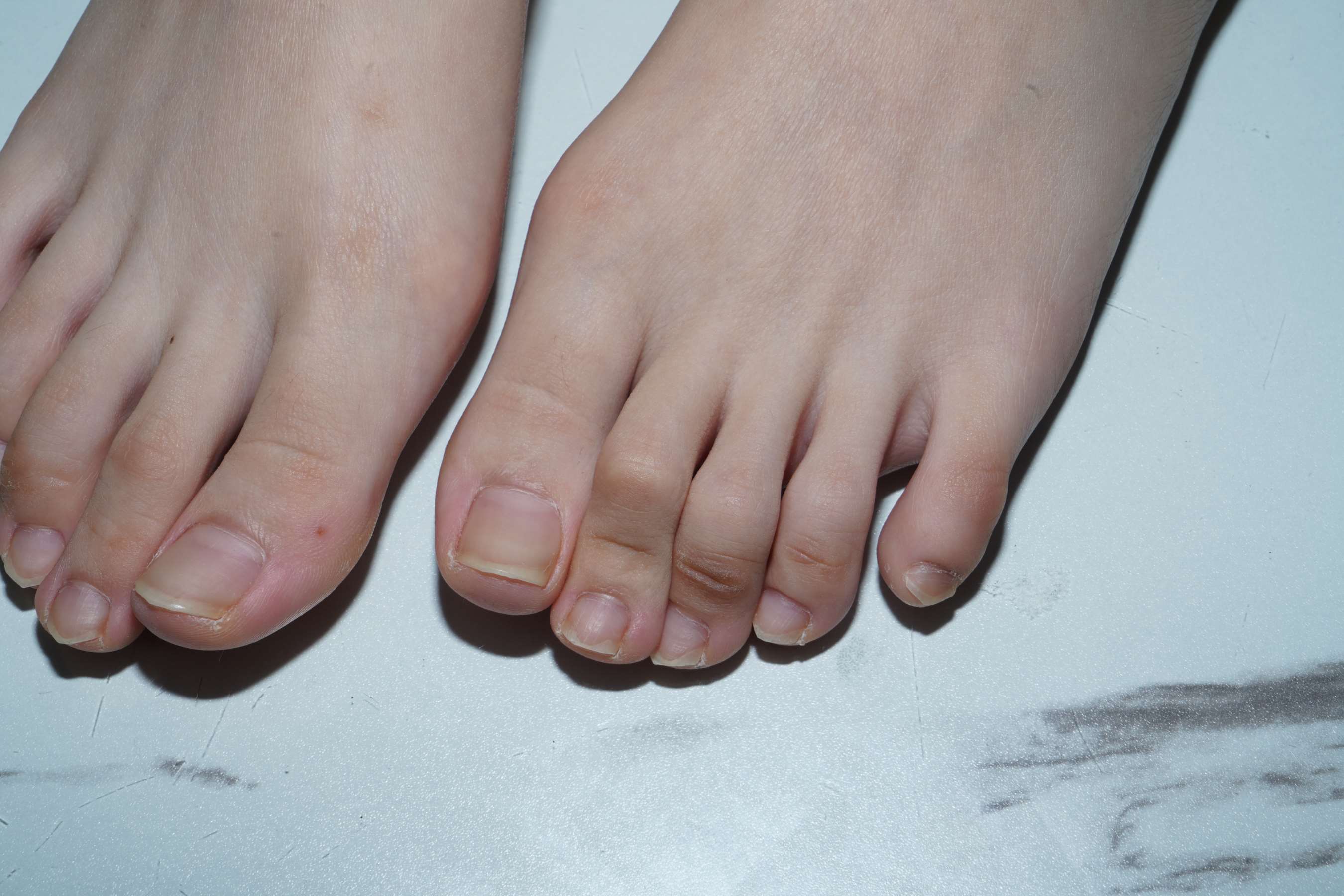 《黄紫的嫩足》作品图