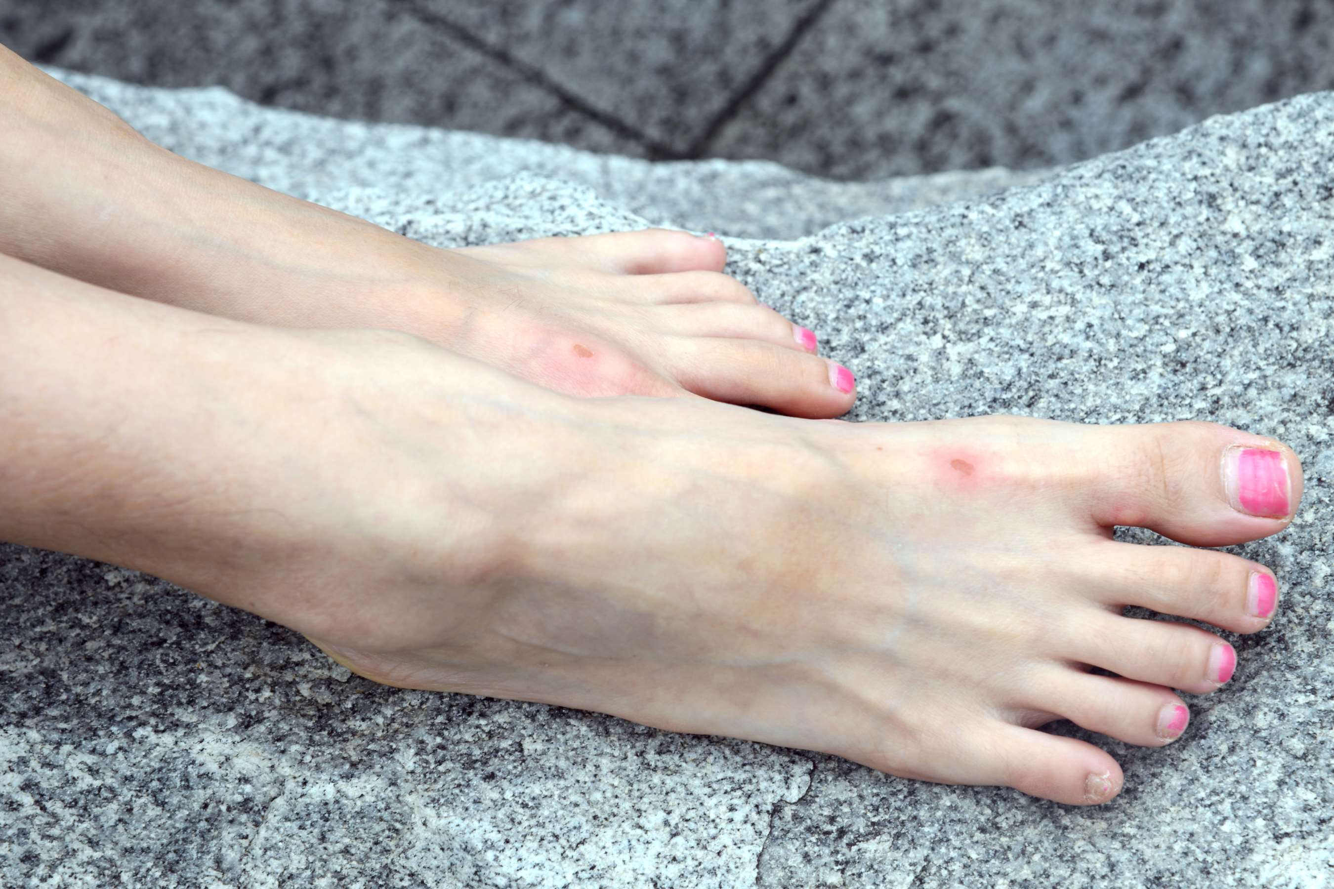 《小慧外景》作品图