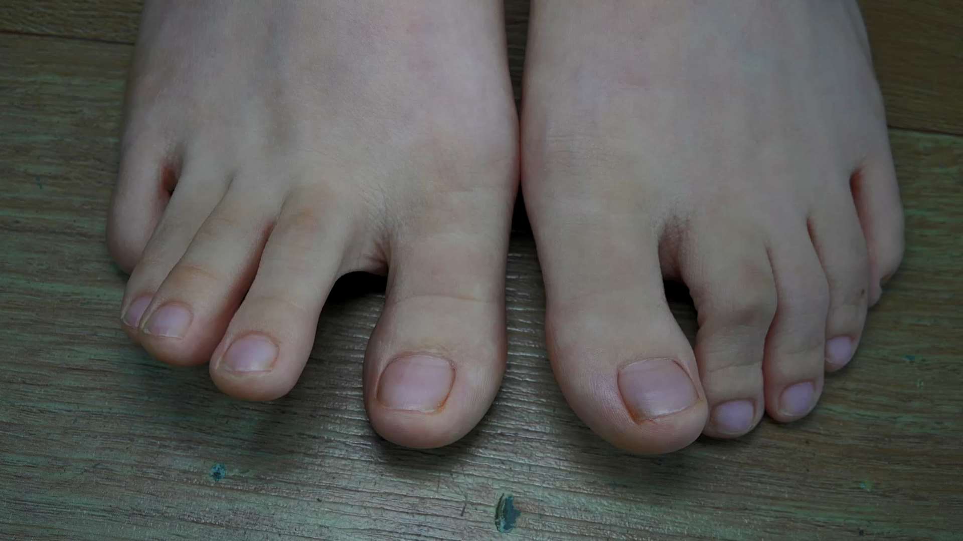 《[视频]芳芳脱帆布鞋展嫩足》作品图