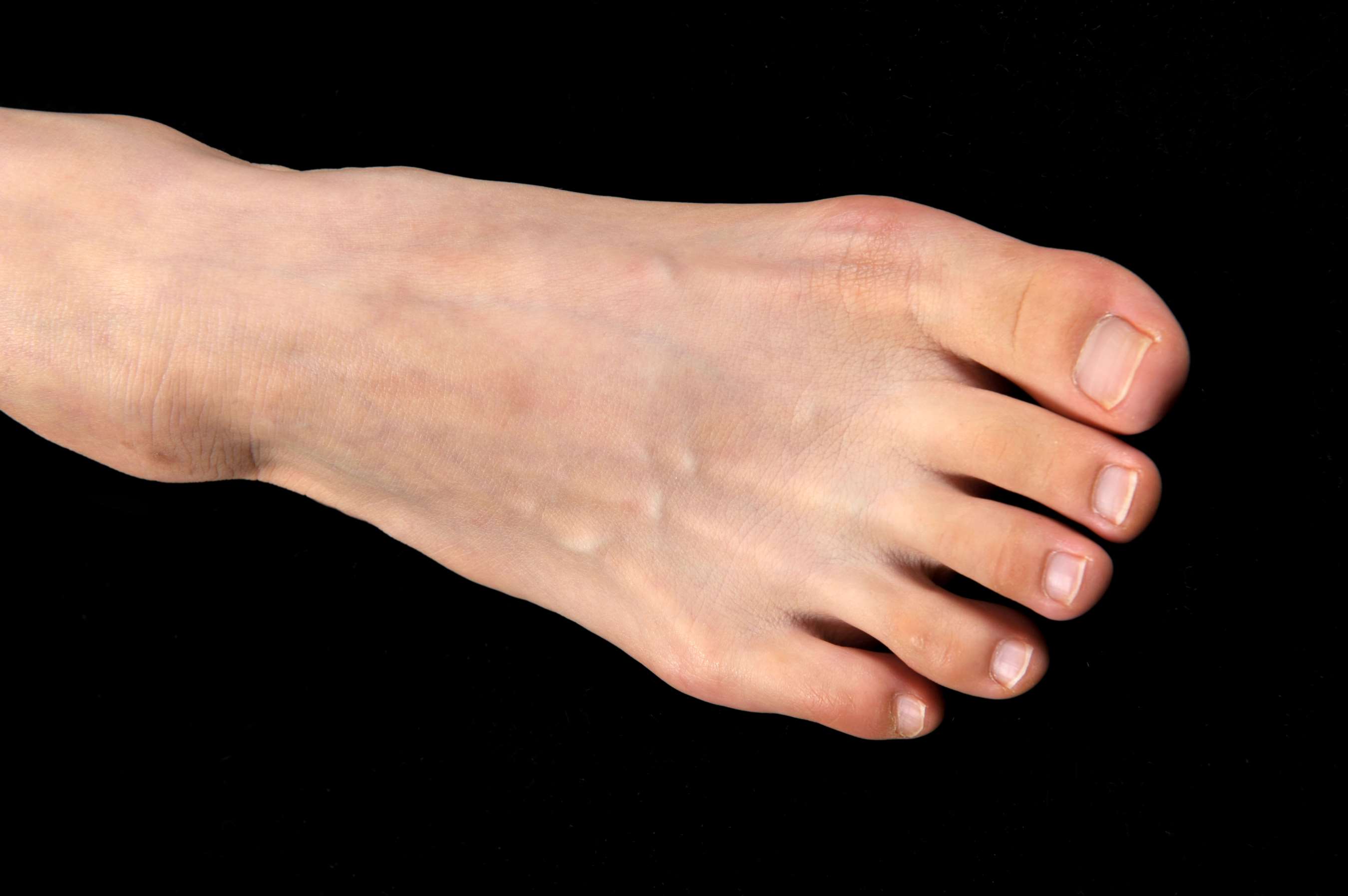 《翼子 黑裙の嫩足》作品图