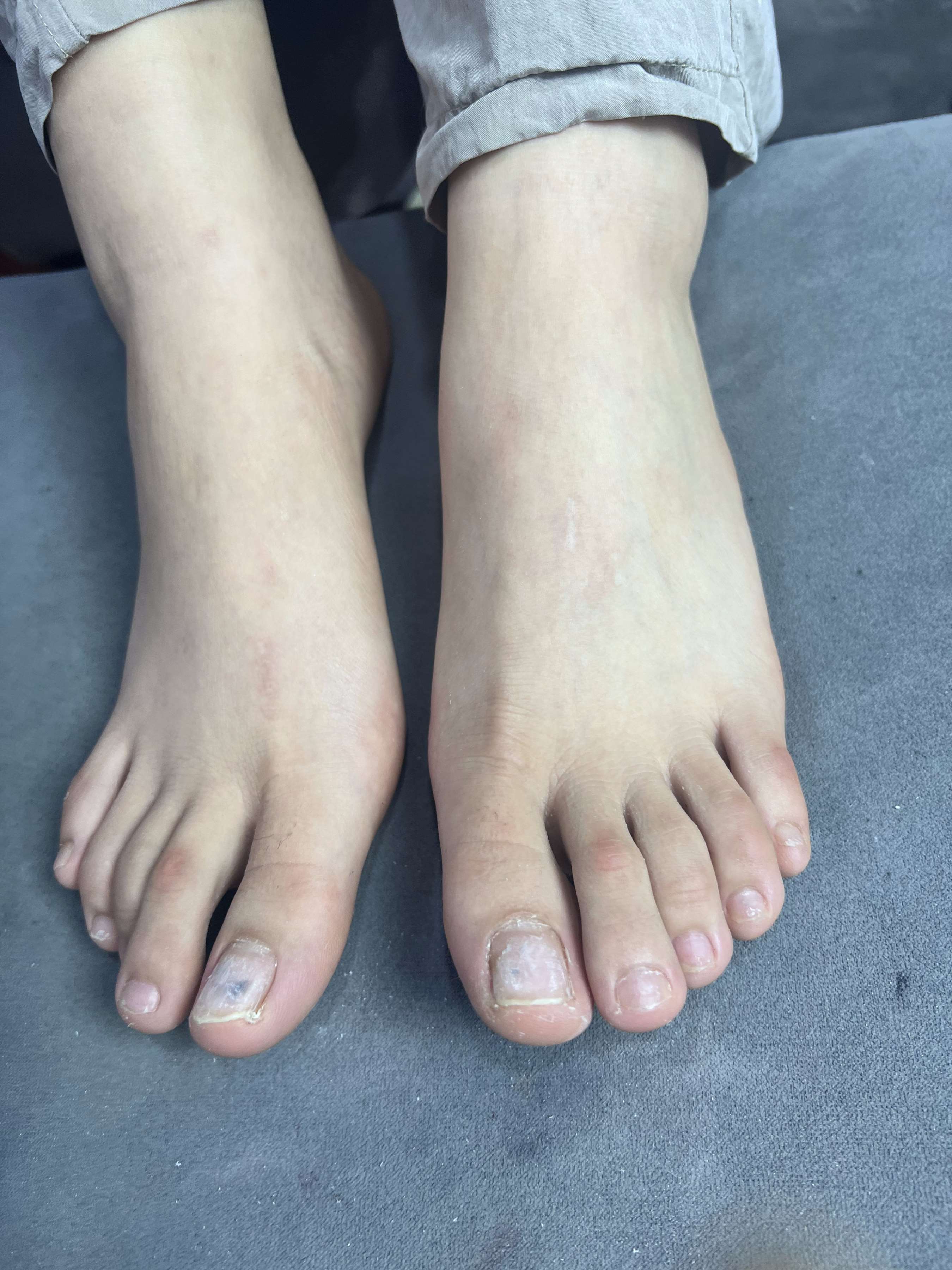 《眼镜妹的大嫩足》作品图