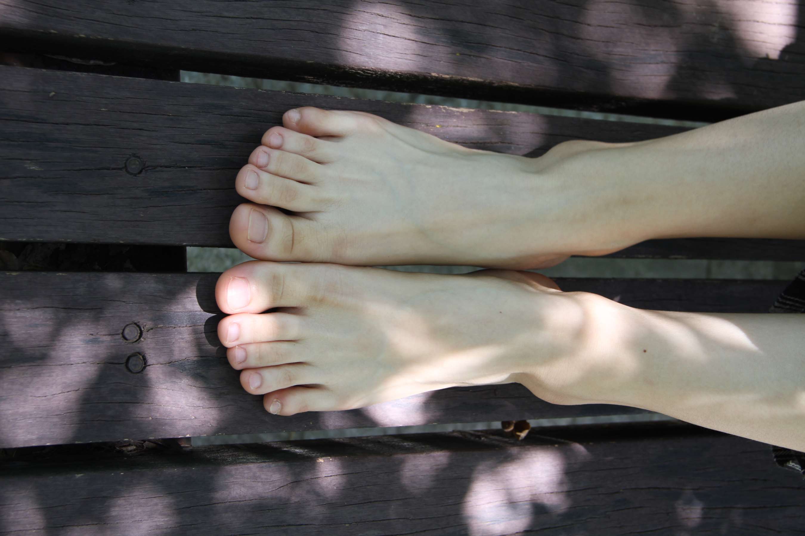 《校园一角 晒晒我的脚丫》作品图