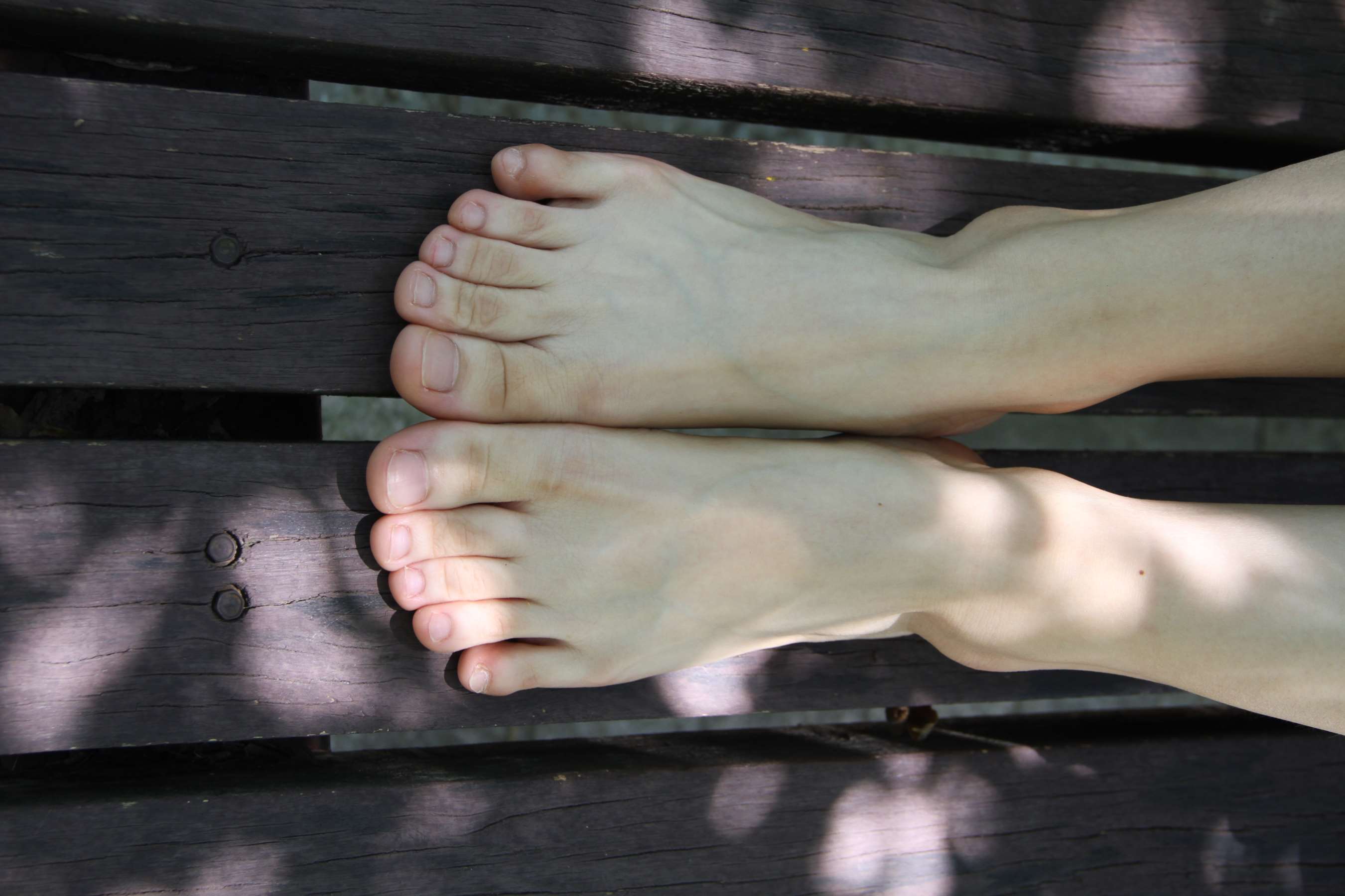 《校园一角 晒晒我的脚丫》作品图